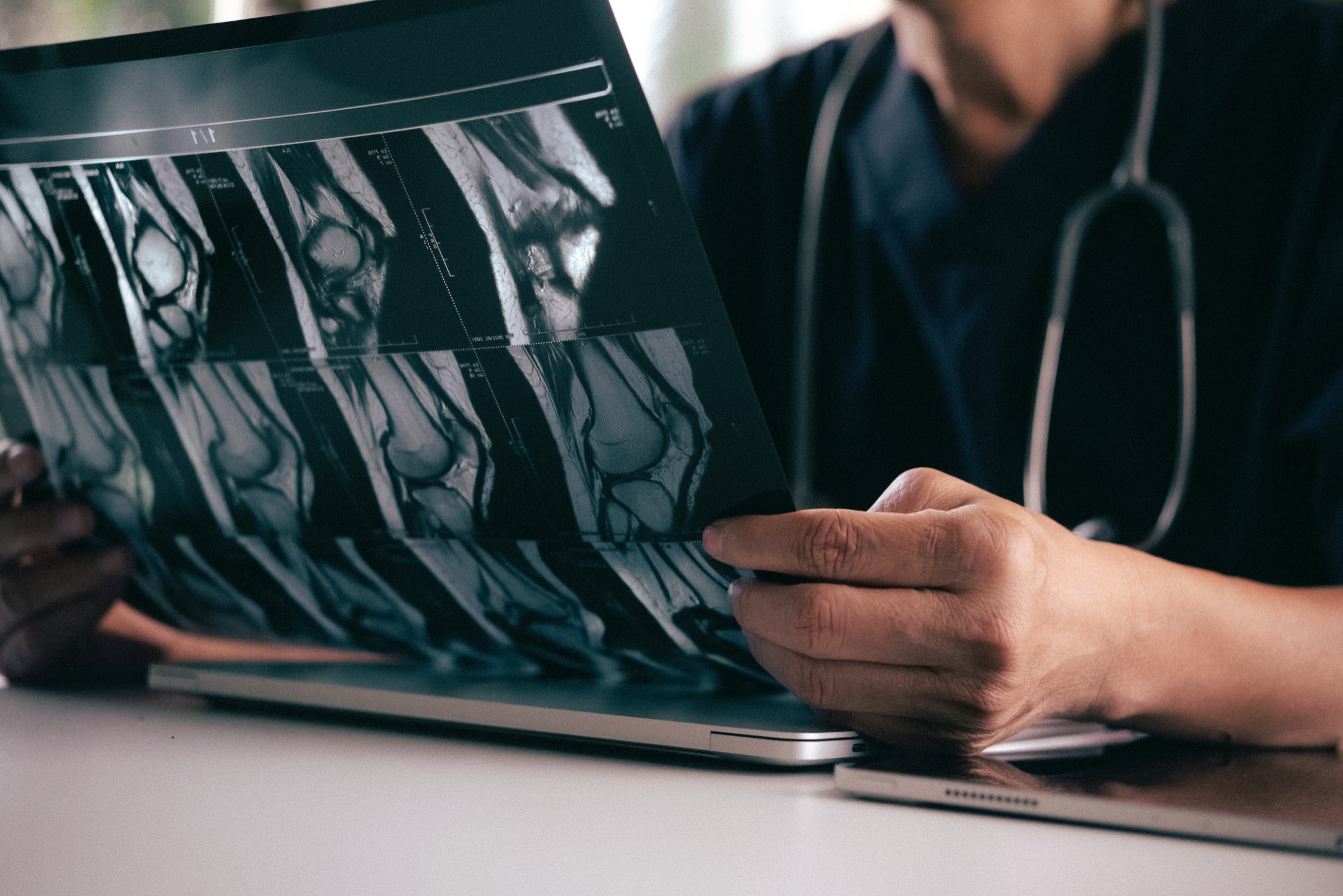 Clinician examining MRI knee imaging films